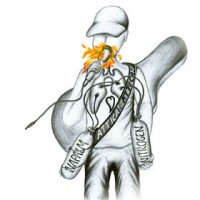 Attica! Attica! - Napalm and Nitrogen