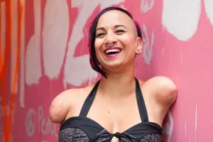 Talli Osborne: "Differences are Beautiful" (TED talk)